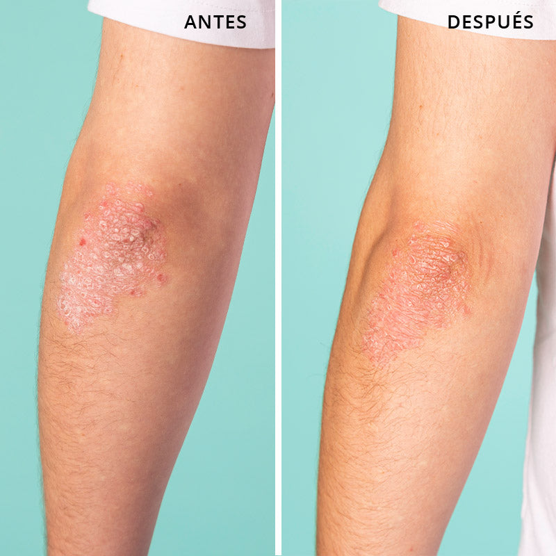 Skin Rescue All-Purpose Balm