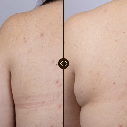 Azelaic Active Body Serum