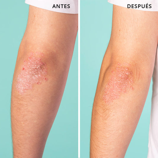 Skin Rescue All-Purpose Balm