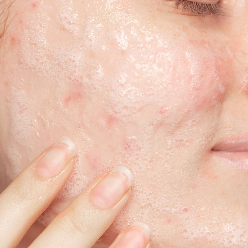 Refill Salicylic Facial Cleanser