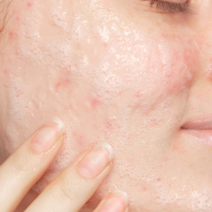 Refill Salicylic Facial Cleanser