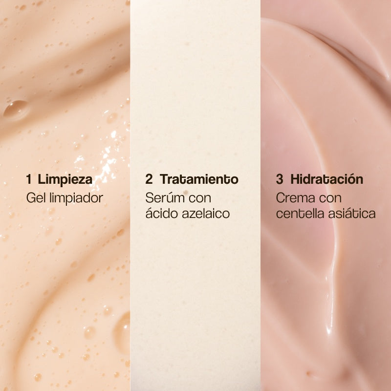 Rosacea Treatment Pack