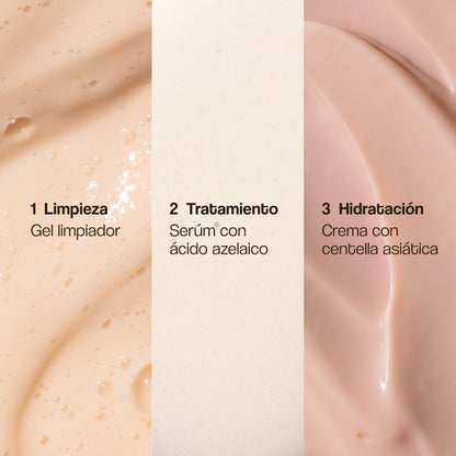 Rosacea Treatment Pack