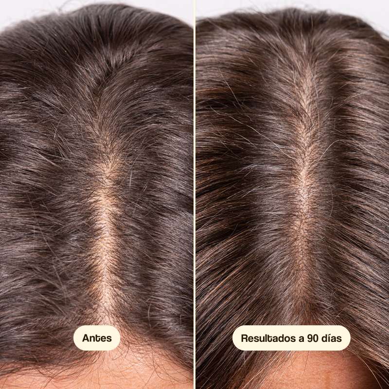 Hair Growth & Density Treatment