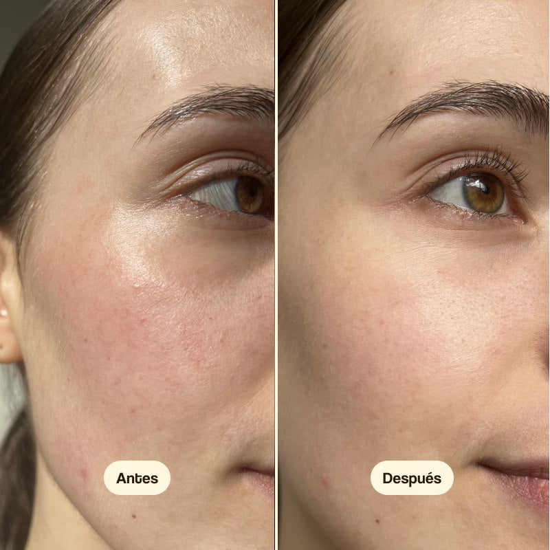 Cica Calm Moisturising Cream