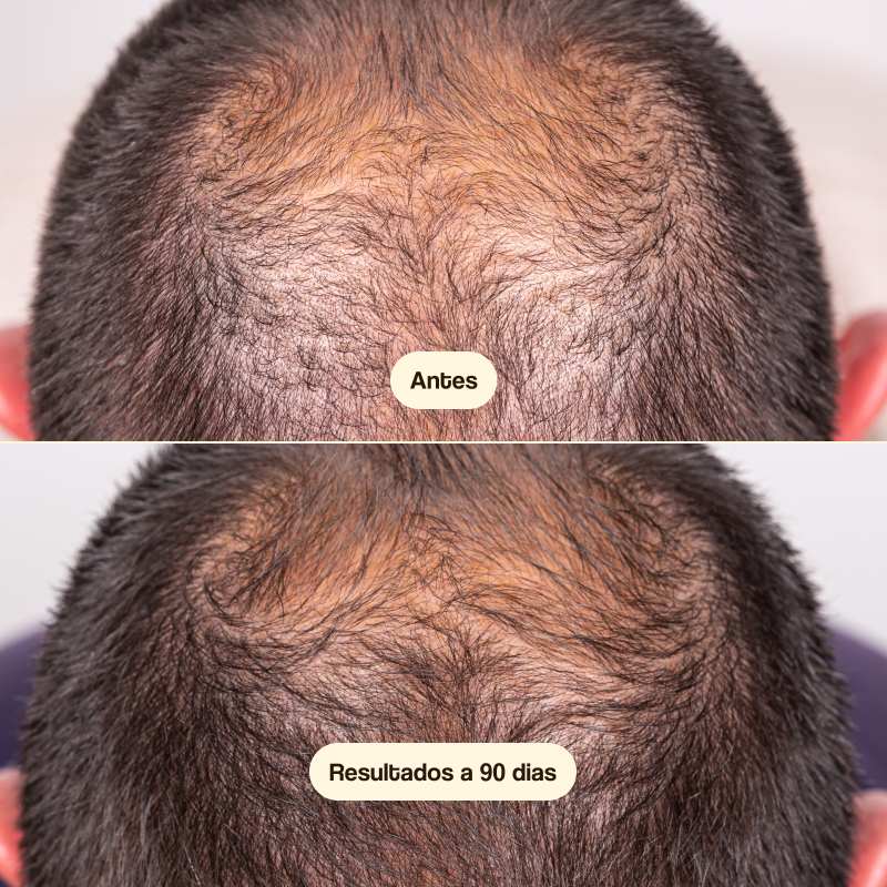 Hair Growth & Density Treatment